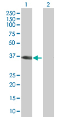 Lane 1: ChGn transfected lysate (32.78 KDa). Lane 2: Non-transfected lysate.