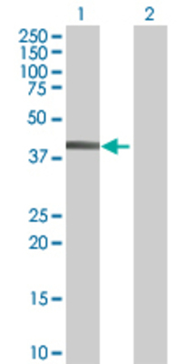 Lane 1: WAPAL transfected lysate (45.6 KDa) Lane 2: Non-transfected lysate.