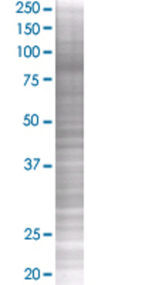 EVI5L transfected lysate.