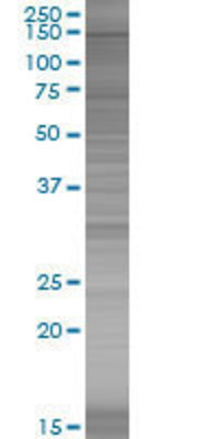 CSPG6 transfected lysate.