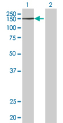 Lane 1: CSPG6 transfected lysate (141.5 KDa) Lane 2: Non-transfected lysate.