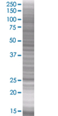 PRDX4 transfected lysate.