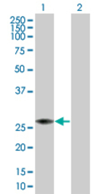 Lane 1: PRDX4 transfected lysate (30.5 KDa) Lane 2: Non-transfected lysate.
