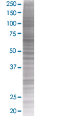 SESN1 transfected lysate.