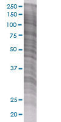 CNR1 transfected lysate.