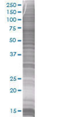 UBE2B transfected lysate.