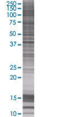 PECI transfected lysate.