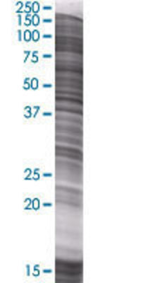 DHFRL1 transfected lysate.