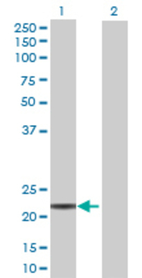 Lane 1: DHFRL1 transfected lysate (20.68 KDa) Lane 2: Non-transfected lysate.