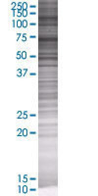 SIP1 transfected lysate.