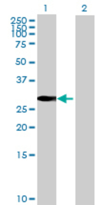 Lane 1: SIP1 transfected lysate (30.91 KDa) Lane 2: Non-transfected lysate.