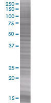 RAB39 transfected lysate