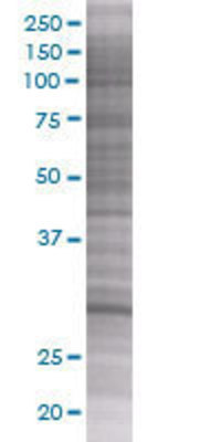 HMOX1 transfected lysate.