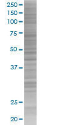FAM107A transfected lysate.