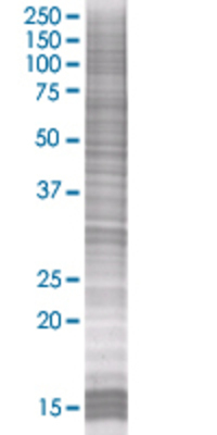 MGC20410 transfected lysate.