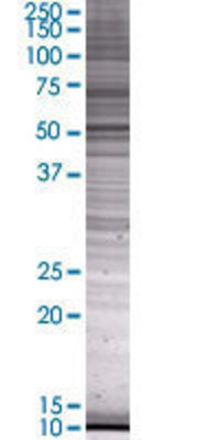 CYP1A1 transfected lysate.