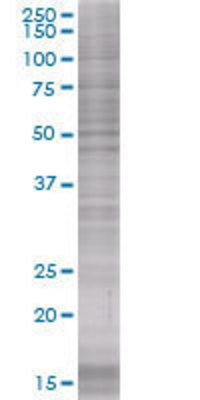 WIF1 transfected lysate