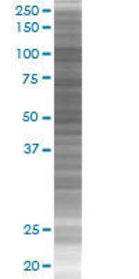 RBM5 transfected lysate.