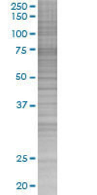 COL4A3BP transfected lysate.