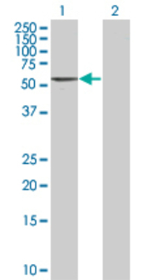 Lane 1: FKBP4 transfected lysate (51.8 KDa) Lane 2: Non-transfected lysate.