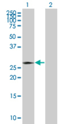 Lane 1: PPT1 transfected lysate (34.2 KDa) Lane 2: Non-transfected lysate.