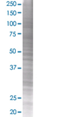 PPT1 transfected lysate.