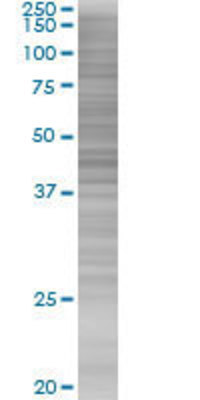 KIR2DL3 transfected lysate.