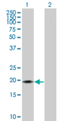 Lane 1: CD3D transfected lysate (18.9 KDa) Lane 2: Non-transfected lysate.