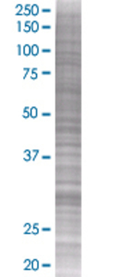 DCK transfected lysate