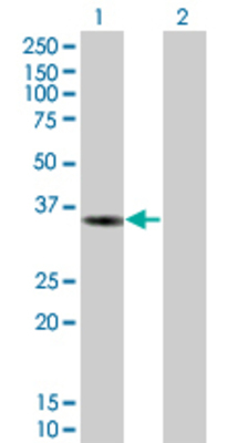 Lane 1: DCK transfected lysate (28.6 KDa). Lane 2: Non-transfected lysate.