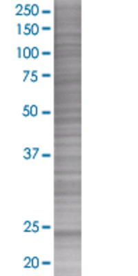 MIS12 transfected lysate.