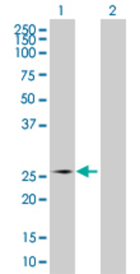 Lane 1: MIS12 transfected lysate (24.1 KDa) Lane 2: Non-transfected lysate.