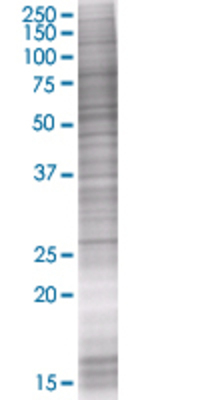 RPE transfected lysate.
