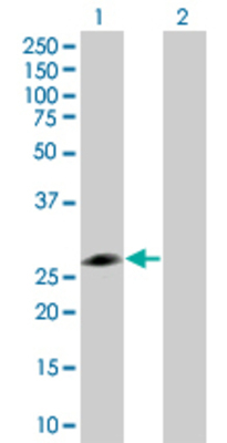 Lane 1: RPE transfected lysate (25.19 KDa) Lane 2: Non-transfected lysate.
