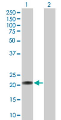Lane 1: C7orf16 transfected lysate (17.9 KDa) Lane 2: Non-transfected lysate.