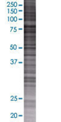 NAP1L3 transfected lysate.