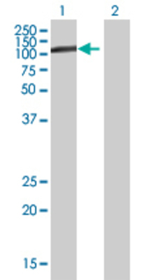 Lane 1: FLJ14981 transfected lysate (51.92 KDa) Lane 2: Non-transfected lysate.