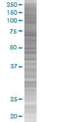FLJ14981 transfected lysate.