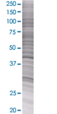 SERPINE1 transfected lysate.
