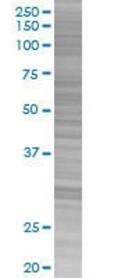 RAP1GDS1 transfected lysate.