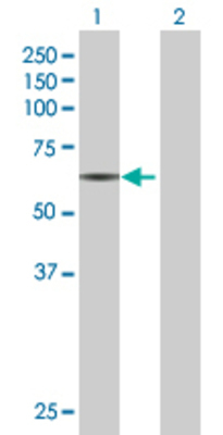 Lane 1: RAP1GDS1 transfected lysate (66.3 KDa) Lane 2: Non-transfected lysate.