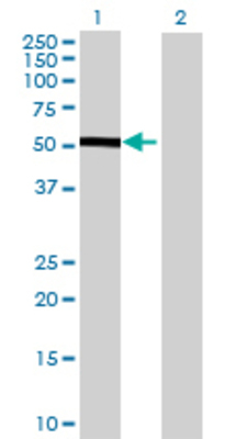 Lane 1: CHST12 transfected lysate (45.65 KDa) Lane 2: Non-transfected lysate.