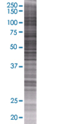 CHST12 transfected lysate.