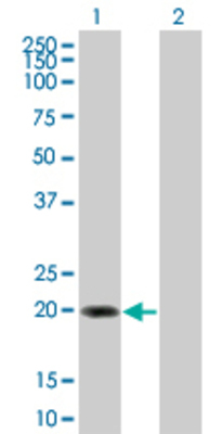 Lane 1: CLEC1B transfected lysate (23.1 KDa) Lane 2: Non-transfected lysate.
