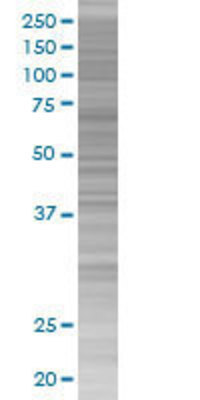 MVK transfected lysate.