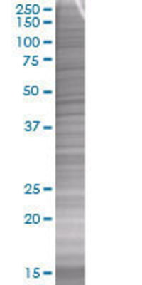 F3 transfected lysate