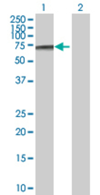 Lane 1: DKC1 transfected lysate (57.7 KDa) Lane 2: Non-transfected lysate.