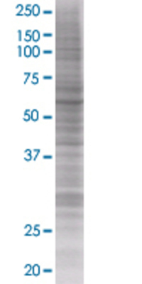 DKC1 transfected lysate.