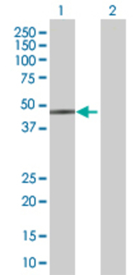 Lane 1: MVK transfected lysate (42.5 KDa) Lane 2: Non-transfected lysate.