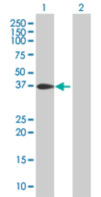Lane 1: FKHL18 transfected lysate (35.4 KDa) Lane 2: Non-transfected lysate.